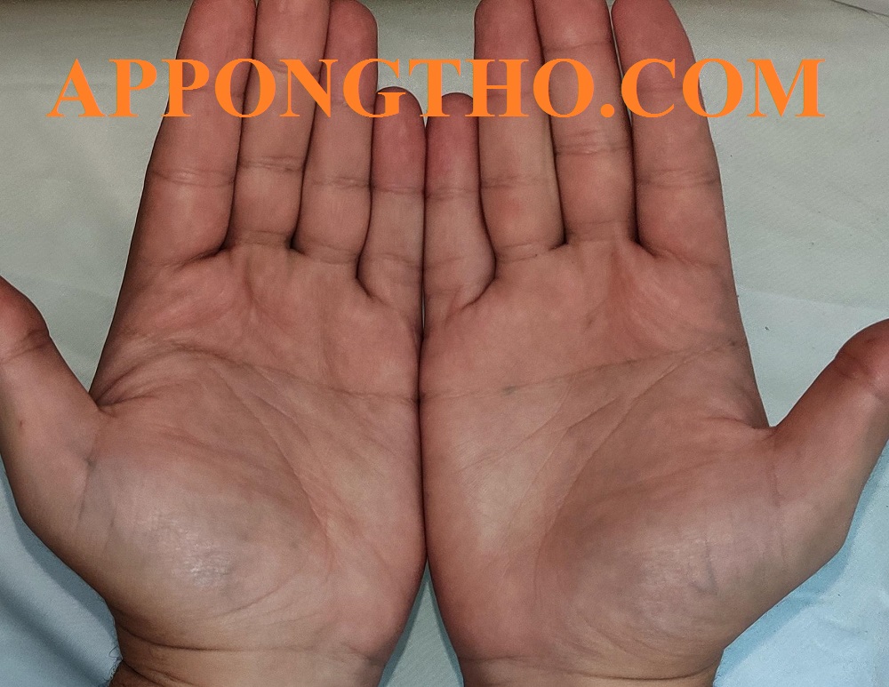 3. Đường sinh đạo rõ, dài và uốn cong đẹp