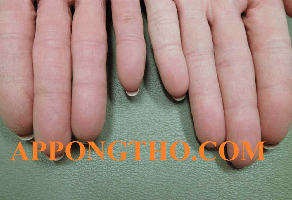 13. Hoa tay hình tròn và xoắn ốc khác gì nhau?