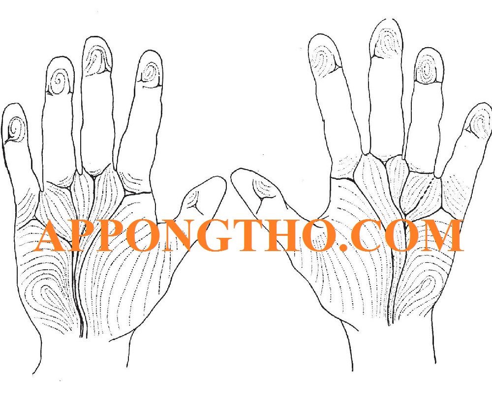 Đặc điểm người không có hoa tay và có từ 1, 2, 3, 4 ,5, 6, 7, 8, 9, 10 hoa tay